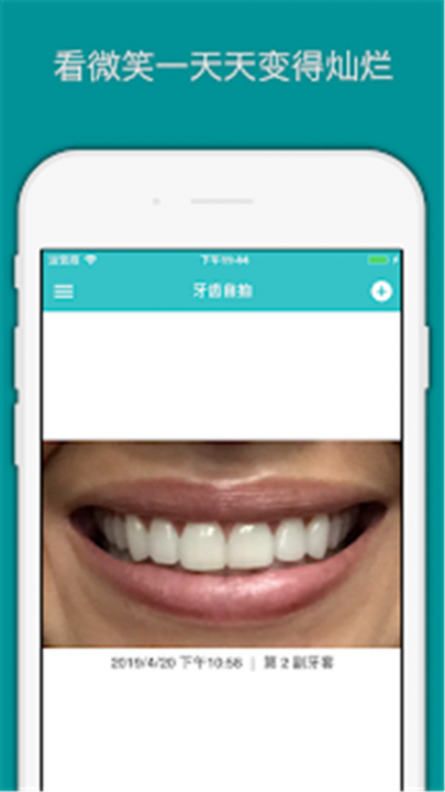 TrayMinder(牙套记录app)3